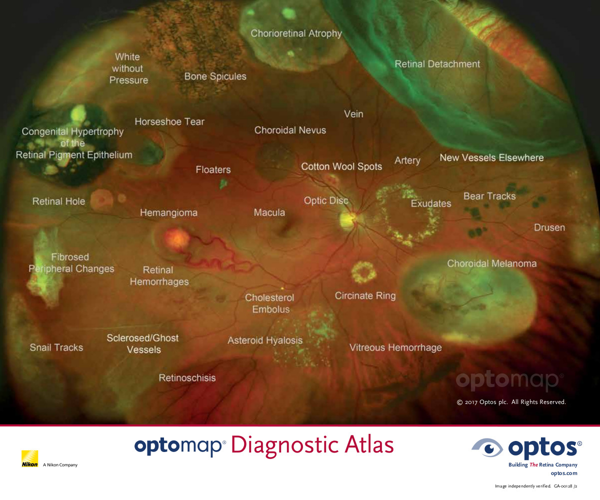 Miami Beach Comprehensive Eye Exams Eye Desire Eye Care and Optical