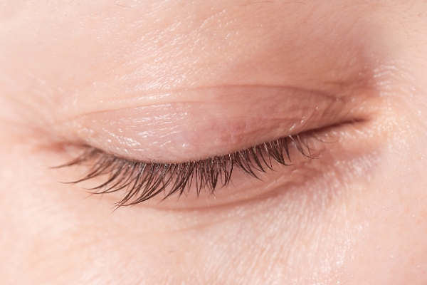 Blepharitis Treatment